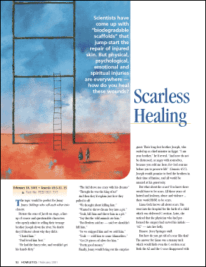 Scarless Healing